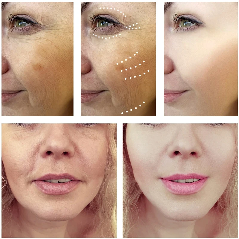 Сыворотка для улучшения шерохо – обзор и цена Placenta Extract Serum