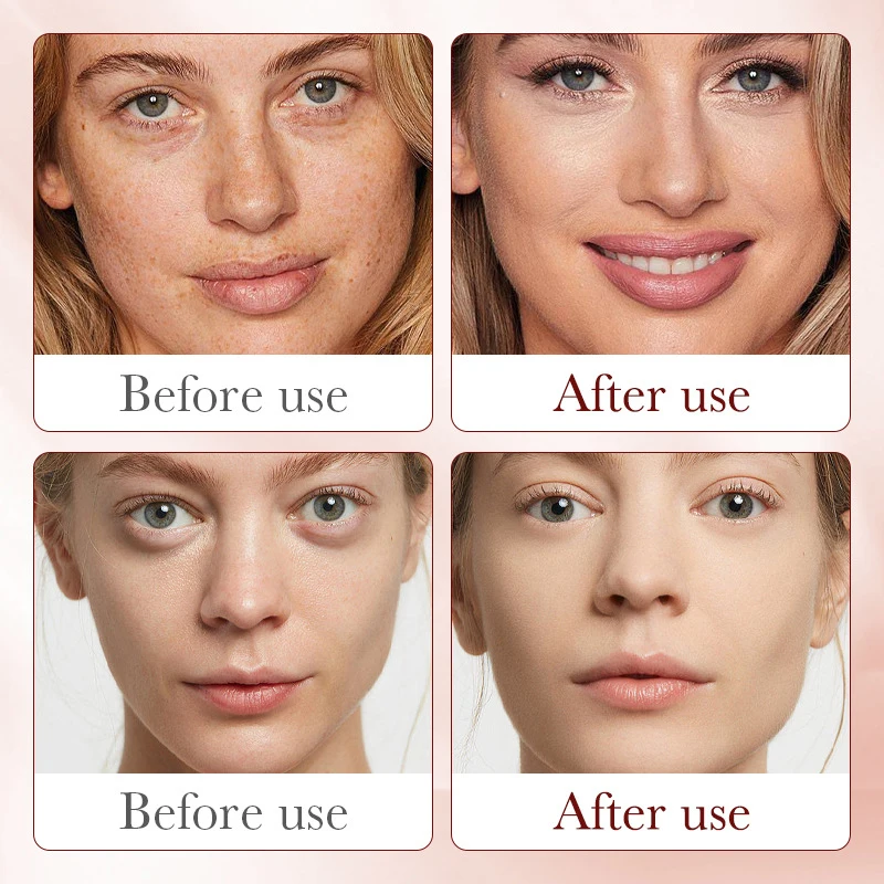 Сыворотка для улучшения шерохо – обзор и цена Placenta Extract Serum